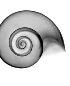 False Ramshorn X-Ray